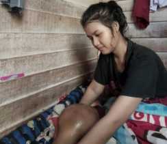 Riska Gadis Kampar Penderita Tumor Butuh Uluran Tangan Dermawan