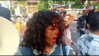 Aksi Berdarah di Depan Kanwil BPN Riau, Massa Desak Presiden Prabowo Copot Pejabat dan Usut Mafia Tanah