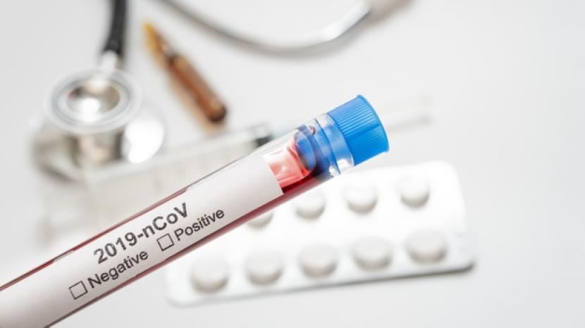 Kemenristek Tegaskan Belum Ada Satupun Obat Spesifik Khusus COVID-19 Kemenristek Tegaskan Belum Ada Satupun Obat Spesifik Khusus COVID-19i