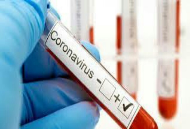 Hasil Swab Negatif Covid-19, Ketua KPU Riau Diizinkan Pulang Hasil Swab Negatif Covid-19, Ketua KPU Riau Diizinkan Pulangi