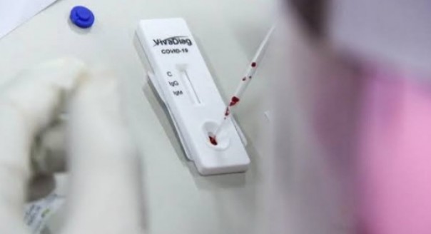 Pemerintah Harus Awasi Biaya Rapid Test Agar Tetap Wajar Pemerintah Harus Awasi Biaya Rapid Test Agar Tetap Wajari