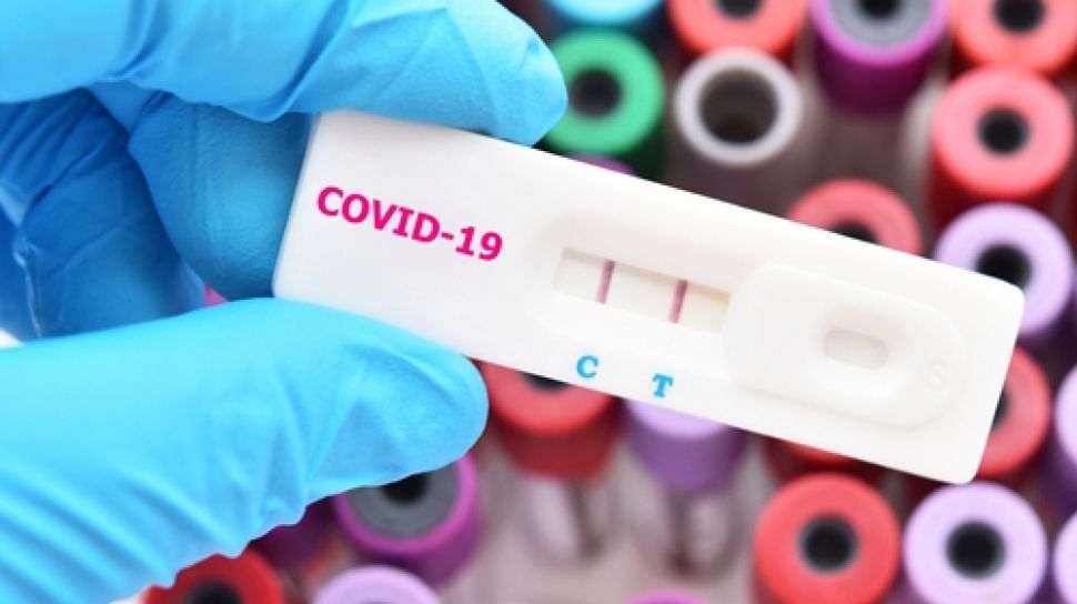 Tes Covid-19 Warga Sekolah tidak Boleh Memberatkan