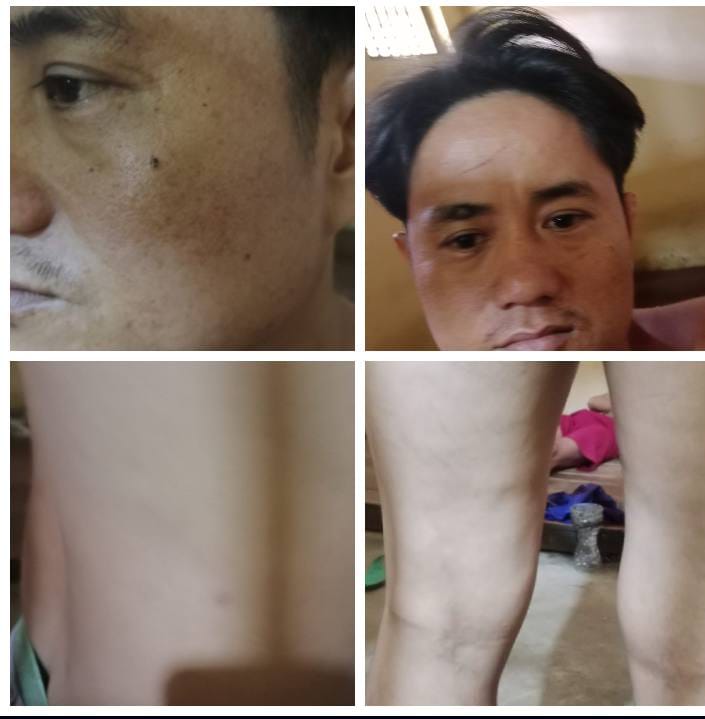 Keluarga Protes Warga Kuansing Ditahan Polisi Usai Dianiaya Security PT Agrinas Keluarga Protes Warga Kuansing Ditahan Polisi Usai Dianiaya Security PT Agrinas