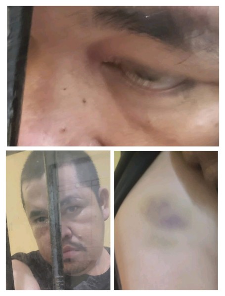 Kapolres Pelalawan Dalam Sorotan: Tahanan Diduga Jadi Korban Kriminalisasi dan Penganiayaan Kapolres Pelalawan Dalam Sorotan: Tahanan Diduga Jadi Korban Kriminalisasi dan Penganiayaan