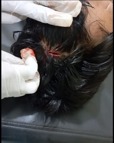 Tanpa Bukti, Warga Talang Danto Dianiaya Oknum Security PTPN IV Kebun Tandun Tanpa Bukti, Warga Talang Danto Dianiaya Oknum Security PTPN IV Kebun Tanduni